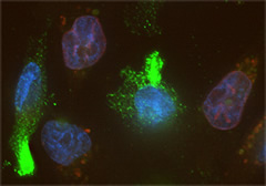 Fig. 5: MDA-MB-231 cells
stained using DAPI, anti-dsDNA antibody,
or mCherry–lamin B2 (arrow).